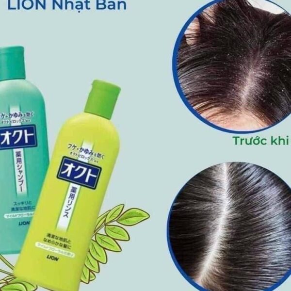 Dầu xả ngăn ngừa gầu và ngứa da đầu Lion 350 ml